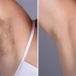 Best Aesthetic Clinic in dubai for Fast Laser Hair Removal Appointments