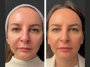 Best Aesthetic Clinics in Dubai Share Expert Advice for Pre-Wedding Skin Care