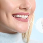 How Do Dental Implants Improve Oral Health And Smile?