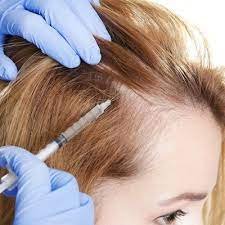 Are the results of PRP hair treatment in Dubai visible on all hair types?