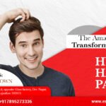 Is Hair Patch in Jaipur Safe and Long-Lasting? Here’s the Truth