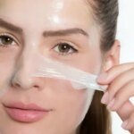 How to Choose the Right Type of Chemical Peel in Islamabad