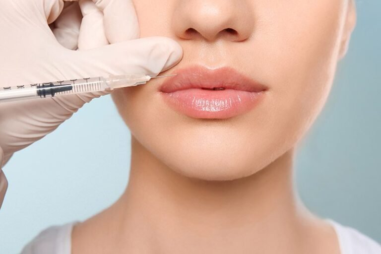 Lip Fillers in Dubai: The Secret to a Balanced and Attractive Face