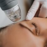 Morpheus8 for Wrinkle Smoothing: Step-by-Step