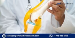 What is Driving the Growth of the Osteoarthritis Therapeutics Market?