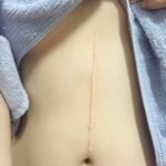 Scar Removal in Dubai: Why Choosing Experienced Specialists Matters