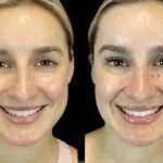 A Guide to Skin Rejuvenation Services at the Best Aesthetic Clinic in Dubai