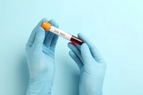 Protect Your Health with Confidential STD Testing in Dubai