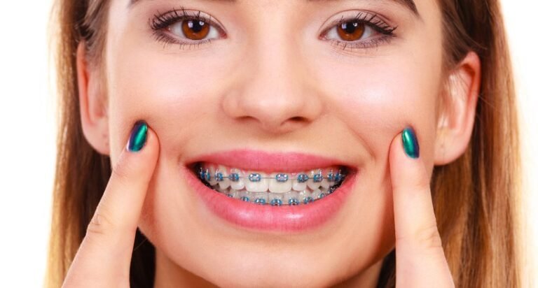 Do Braces Hurt? Real Expectations