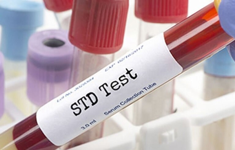 When Should You Get an STD Test?