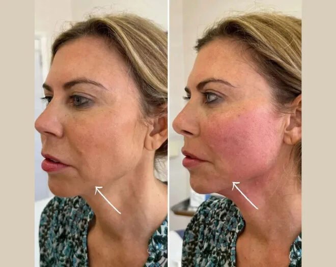 Why Celebrities Trust Endolift with the Best Doctors in Dubai