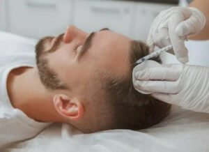 PRP Hair Treatment in Islamabad for Damaged Follicles