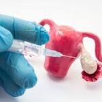 Oocyte Freezing | Egg Freezing | Hyderabad | Gachibowli – Dr Sravya Buggana