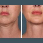 Best Plastic Surgeons in Dubai for PRP Treatment: Safe Choice