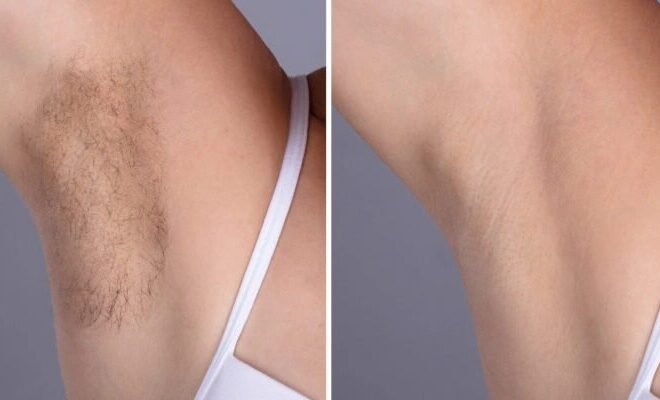 Best Plastic Surgeons in dubai Specializing in Laser Hair Removal