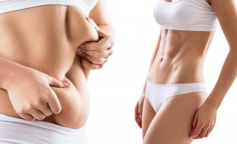 How the Best Liposuction Surgeons in Dubai Redefine Body Contouring