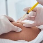 Lemon Bottle Injection: Body Shaping Made Simple