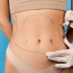 Affordable and Skilled: Best VASER Liposuction Surgeons in Dubai Revealed