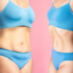 عملية شفط الدهون في الشتاء: أفضل موسم للعملية المثالية