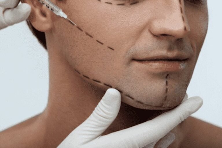 Jaw Surgery in Islamabad for Jaw and Bite Alignment