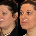 Best Doctors in Dubai for Sculptra Trust