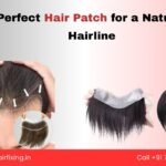 Why Hair Replacement Is More Popular Than Ever