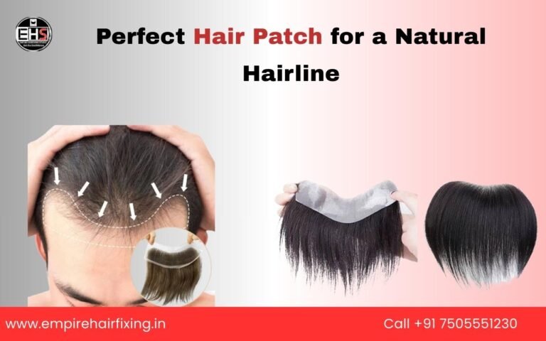 Why Hair Replacement Is More Popular Than Ever