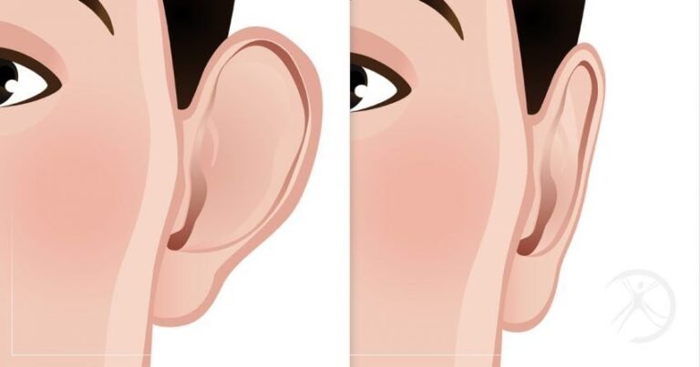 Ear Reshaping in Islamabad: Achieve Natural-Looking Ears