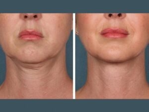 Best Plastic Surgeons in Dubai Offering Professional PRP Treatment