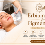 Laser Treatment for Acne Scars: Advanced Solutions for Clearer and Healthier Skin