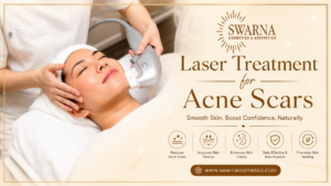 Swarna Cosmetics Expert Laser Treatments For Acne Scars And Pigmentation