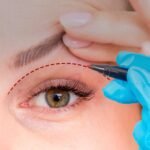 Eyelid Surgery in Islamabad and Personalized Treatment Plans