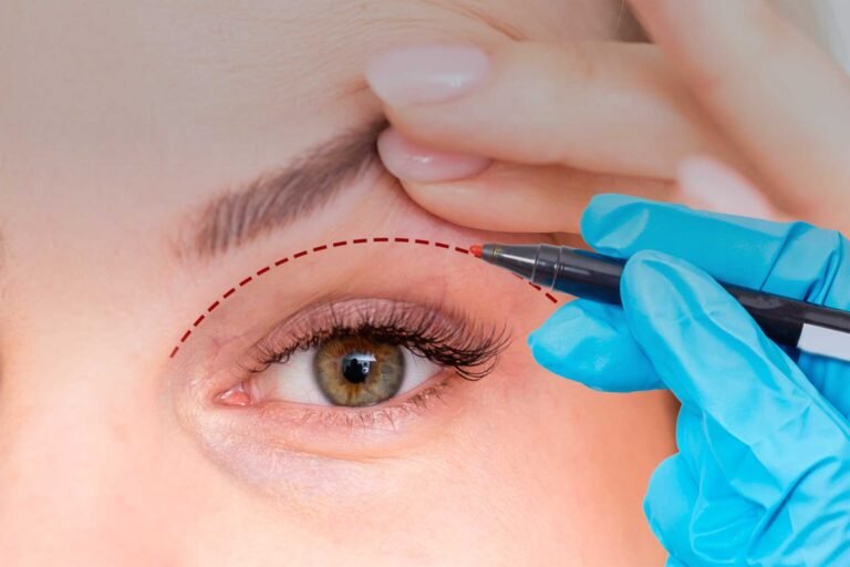 Eyelid Surgery in Islamabad and Personalized Treatment Plans
