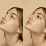 How Rhinoplasty in Islamabad Contributes to a Harmonious Facial Profile