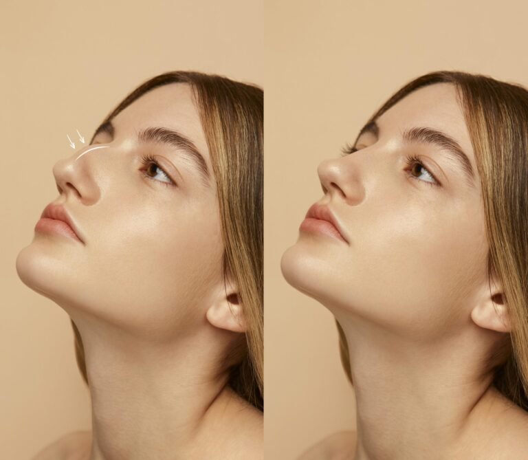 How Rhinoplasty in Islamabad Contributes to a Harmonious Facial Profile
