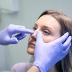 Rhinoplasty in Islamabad: Exploring the Latest Trends in Modern Nose Surgery