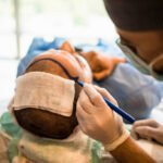ماذا تتوقع بعد مرور عام على زراعة الشعر في دبي؟