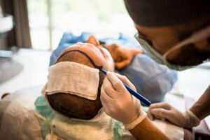 ماذا تتوقع بعد مرور عام على زراعة الشعر في دبي؟