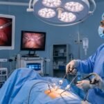 Top 7 Questions to Ask Before Choosing Laparoscopic Surgery