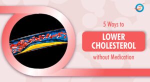 5 Ways to Lower Cholesterol Without Medication
