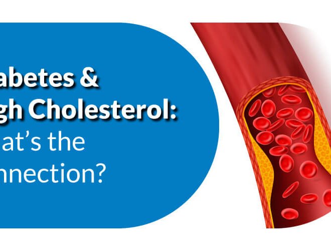 Diabetes and high cholesterol: what’s the connection?