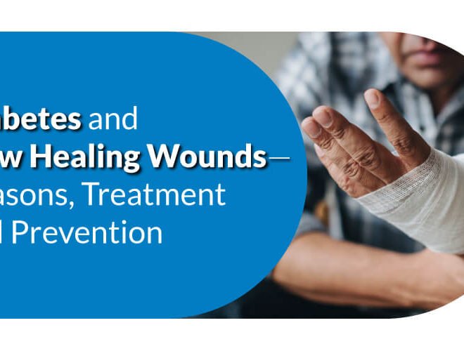 Diabetes and Wound Healing: Reasons, Treatment and Prevention
