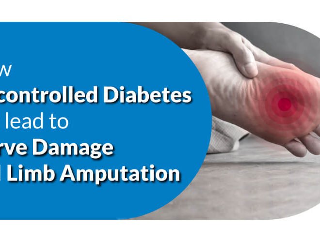 How Uncontrolled Diabetes Can Lead to Nerve Damage and Limb Amputation?