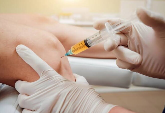 PRP Injections for Joint and Spine Pain: What Patients Should Know